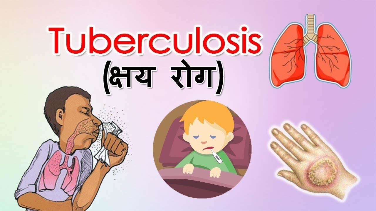 लहलदापुर में 100 तो मशरख के 87 प्रतिशत टीबी मरीजों ने सहायता के लिए जताई सहमति: डीपीसी